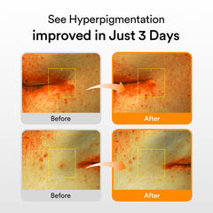 Abib Glutathiosome serum texture on skin highlighting quick absorption and non-greasy finish