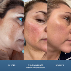 Serum Admire My Skin en envase compacto, facilita uso diario.