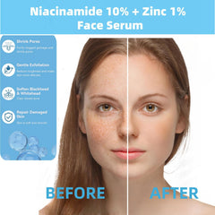 AFCRYIYE Niacinamida y zinc: aplicación para piel grasa y poros más definidos.