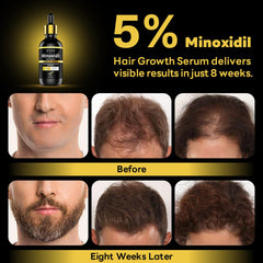 Andelusita Minoxidil Biotina y nutrientes para folículos capilares