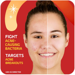 Compact 1oz packaging of Asepxia cream ideal for travel.