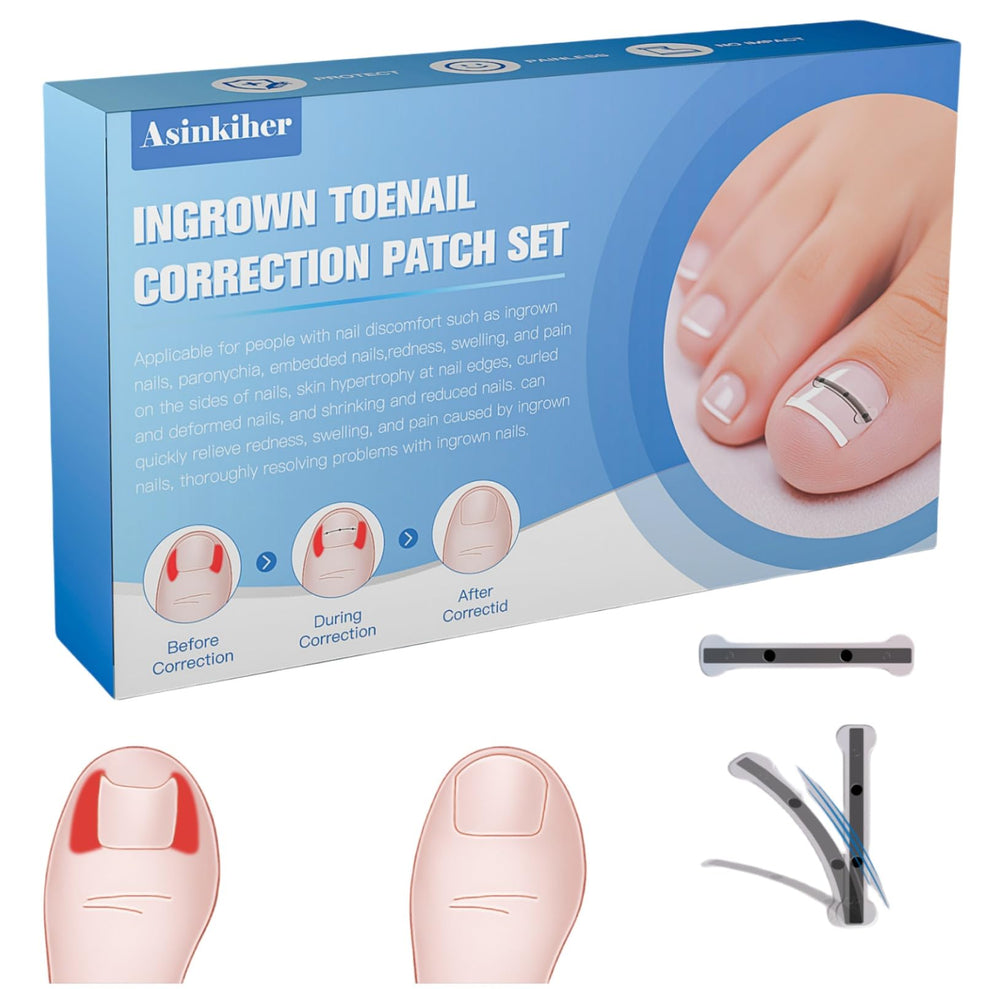 Asinkiher traitement ongles incarnes alliage titane, correction précise et durable.