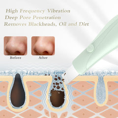 Cabezal suave de Auioytoy para puntos negros, exfoliación delicada sin irritación.