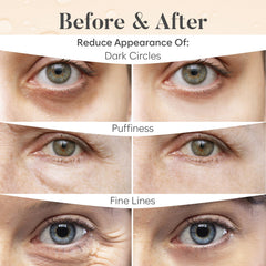 AURAE parches ojos rosa: luminosidad natural para piel sensible