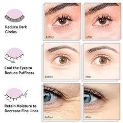 AVJONE parches ojos hidratación intensa para piel cansada