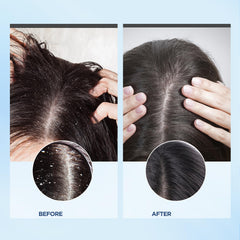 Bablabear Scalp Exfoliator Scrub ingredients highlight coconut oil and charcoal for balance