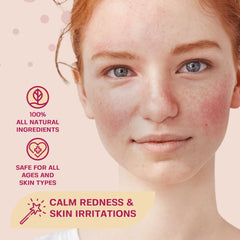 BASE LABORATORIES spray hipocloroso para piel sensible, ayuda a la irritación suave.