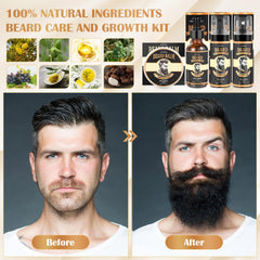 Beauntangly kit crecimiento barba balsamo: hidratación profunda para barba suave.
