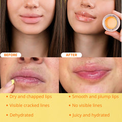 Vitamin E rich Bee Balm softens lip texture and lines.
