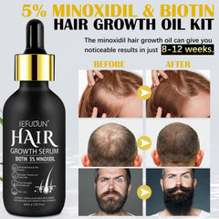 Bieyoc Minoxidil Sérum: aplicación con dedos para absorción rápida en el cuero cabelludo.