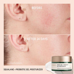 Probioticos encapsulados de Biossance: fortalece el microbioma de la piel.
