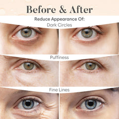BLOOMORA parches ojos niacinamida: mejora elasticidad suave