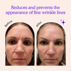 BLUMBODY forehead wrinkle patches reduce the appearance of furrows while you rest.