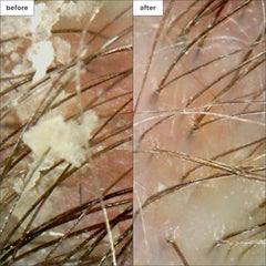 Briogeo Renovación aceite de coco, hidratación para suavizar el cabello