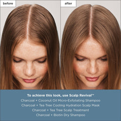 Briogeo Scalp Revival hidrata con ácido hialurónico para balancear.