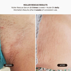 Bushbalm Aplicación Rodillo Frío mejora la experiencia durante depilación.