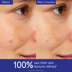Caudalie Vinoperfect Esencia Iluminadora: gotas suaves para exfoliar ligeramente.