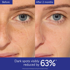 Réduction des taches avec Viniferine et Caudalie Vinoperfect.