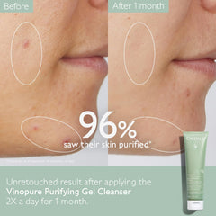 Caudalie Vinopure aceites esenciales y polifenoles purifican y protegen la piel.