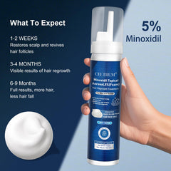 Celtrum Minoxidil Foam on scalp for targeted hair support.