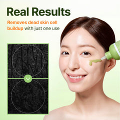 CENTELLIAN 24 Madeca Matcha Peeling Gel cápsulas de carbón para limpiar poros