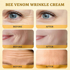 CHEOKINGBA crema veneno abeja cara y cuello con textura ligera