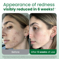 Toallas Clean Skin Club XL con aloe y glicerina para hidratación suave