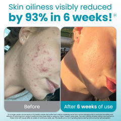 Toallas infundidas con aloe vera y glicerina Clean Skin Club para piel sensible.