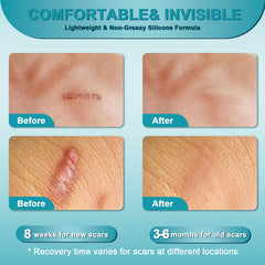 ClearPiny crema cicatrices, tratamiento versátil para cara y cuerpo, reduce enrojecimiento.