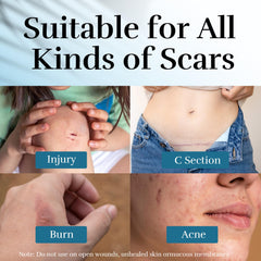 CLNABFR dermatologist-approved formula bottle highlights safety for sensitive skin