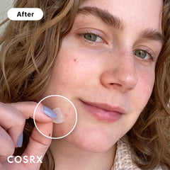 COSRX paquete de 24 parches, tres tallas para áreas faciales