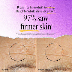 Derma E crema firmante DMAE, primer plano de aplicación en rostro y cuello para hidratación suave.