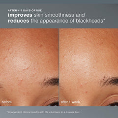 Dermalogica Daily Microfoliant, aplicación diaria suave, ideal para antes del maquillaje