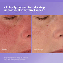 Dermalogica Textura crema suave, ideal para alivio de irritaciones en la piel