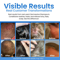 Dermasolve Champú aplicación-manual: masaje suave para cobertura uniforme.