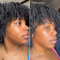 Dermisa Skin Fade Cream con vitamina C y regaliz para claridad y brillo.