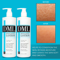 Texture-souple de DML, absorption rapide sans résidu gras.