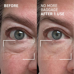 Dr. Brandt Needles No More: aplicación en gel caliente para efecto suave