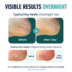 Dr. Frederick's Original tejido de algodón talones abiertos para ventilación