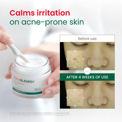 Aplicación con las manos de Dr. G Red Blemish Clear facilita hidratación diaria.