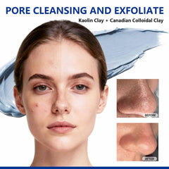 Dr Vincent Deep Pore: textura cremosa de arcilla azul, fácil de aplicar para piel suave.