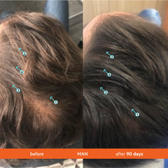 Cabello con aspecto más lleno tras uso constante de Revita.