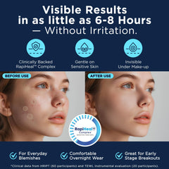 Parche Dura Cleanse para cara, cobertura invisible, se integra con maquillaje diario.