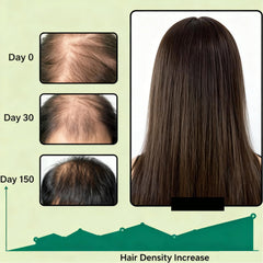 EBEHDOQ Nuvara Champú, tapa visible, fórmula con cafeína para cuero cabelludo energizado.