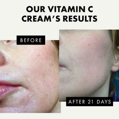 Uso diario: aplicación diaria de Eclat Skincare Vitamina C para piel más fresca