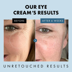 Eclat Skincare under eye cream helps smooth fine lines around the eyes.