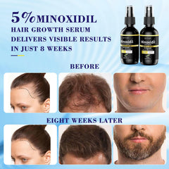 Absorción en 60 segundos de Elegra Minoxidil, sin grasa.