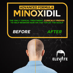 Medida de 1 ml: dosis exacta para cada aplicación de Elevate Minoxidil.