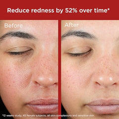 EltaMD Recuperación de Piel Mineral con rápida absorción para rostro diario.