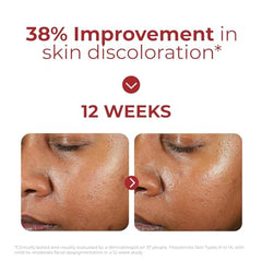 EltaMD UV Clear SPF 46 tono adaptable para tonos profundos.